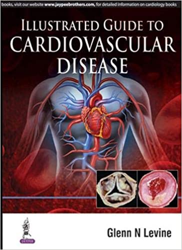 Illustrated Guide to Cardiovascular Disease