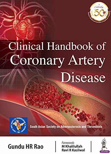 Clinical Handbook of Coronary Artery Disease