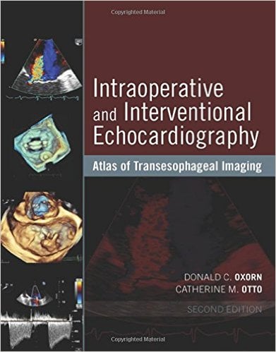 Intraoperative and Interventional Echocardiography: Atlas of Transesophageal Imaging, 2nd Edition