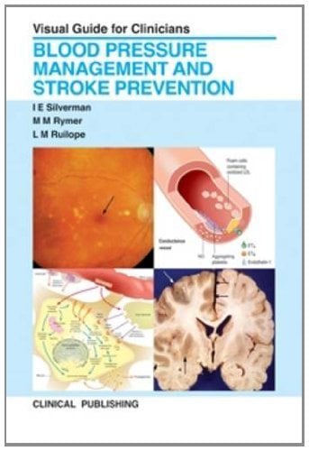 Blood Pressure Management and Stroke Prevention