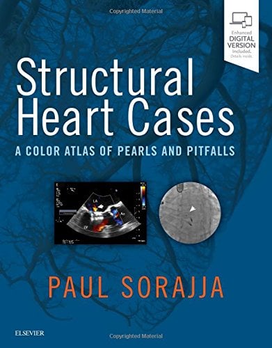Structural Heart Cases: A Color Atlas of Pearls and Pitfalls, 1e