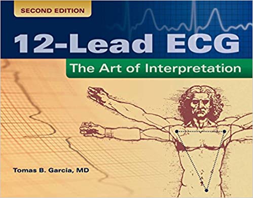 12-Lead ECG: The Art of Interpretation, 2nd Edition
